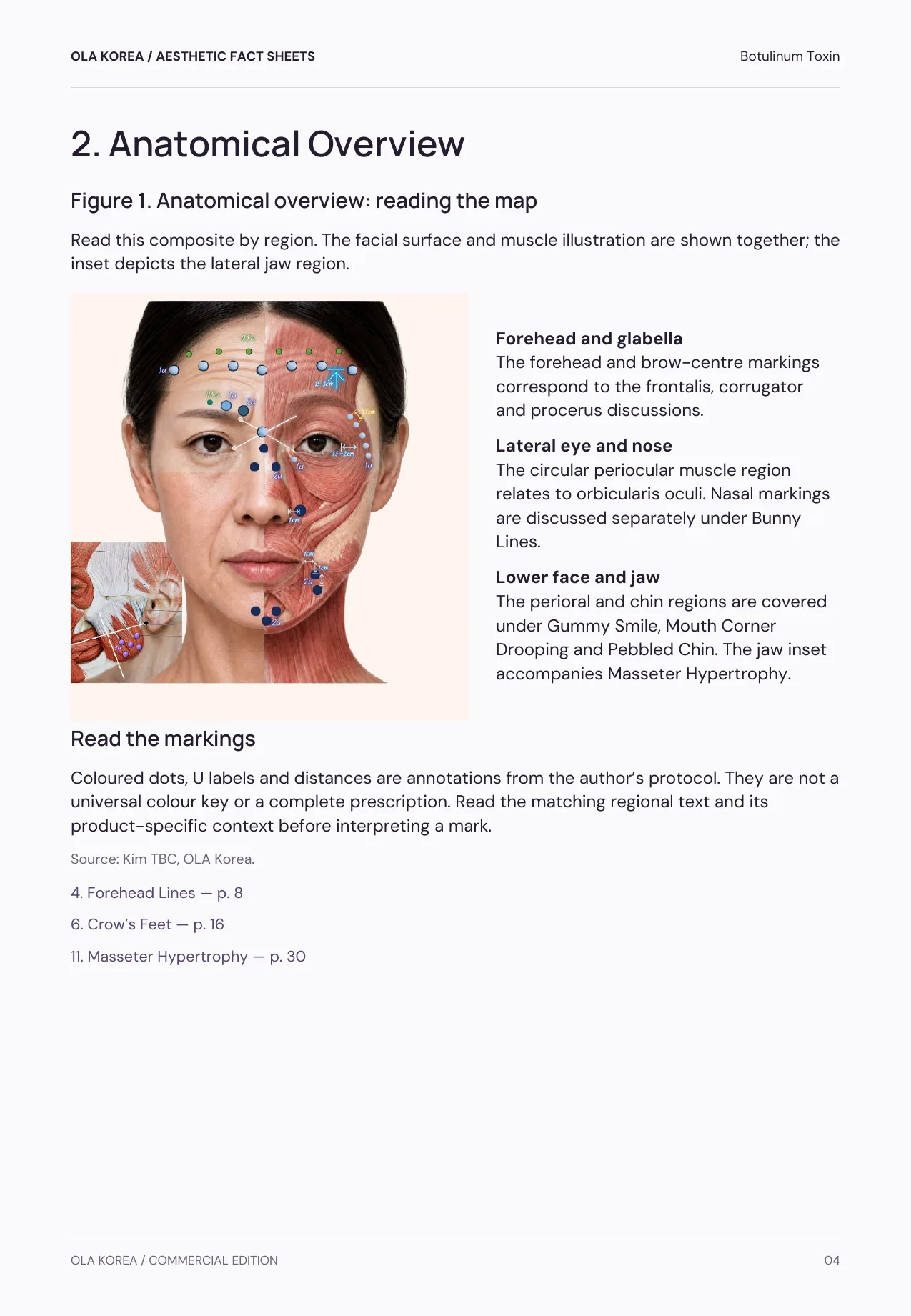 Botulinum Toxin — 2. Anatomical Overview, PDF page 4: How to read the facial muscle map region by region.